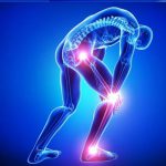 Banyak pilihan Dokter Spesialis Orthopaedi dan Traumatologi di Malang (C) inhomepersonaltrainerdallas